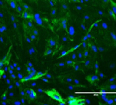 DAPI_Desmin stained stellate