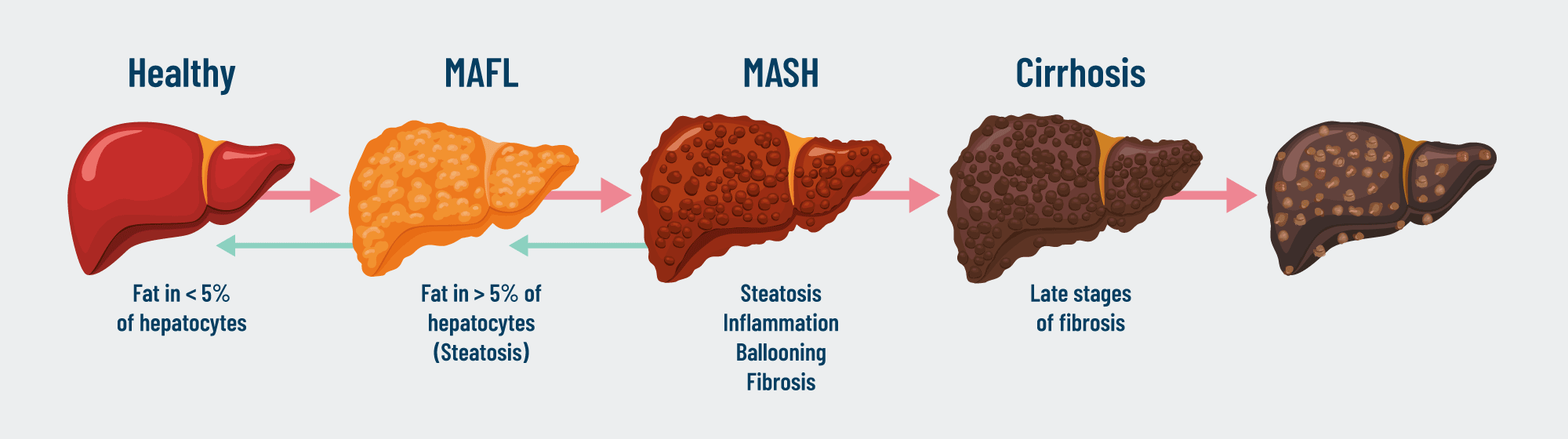 def008_liver-disease-progression_v1