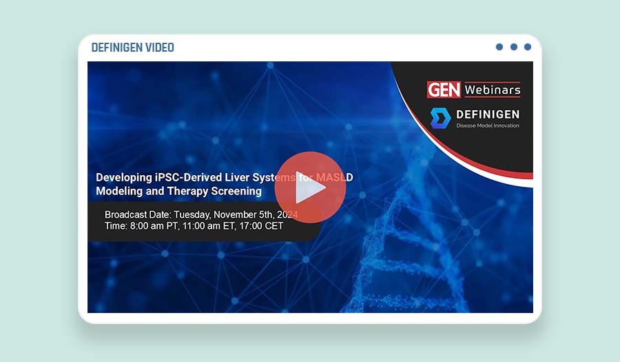 Developing iPSC-Derived Liver Systems for MASLD Modeling and Therapy Screening