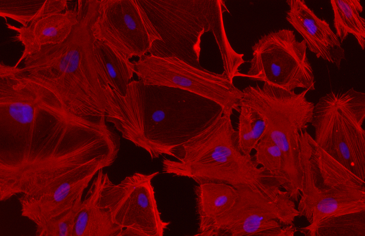 Image of iPSC-derived hepatic stellate cells